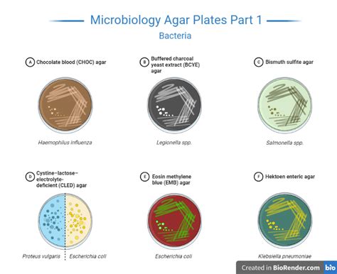 Agar Plates- Definition, Composition, Types, Procedure - Sciencevivid