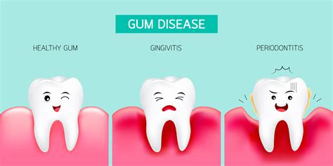 How to Avoid Gum Disease: What You Need to Know