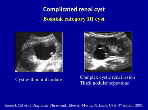 MEDICAL ULTRASOUND/RENAL CYST