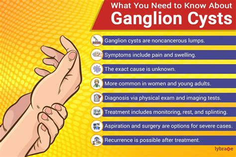 Ganglion Cyst Symptoms And Causes Mayo Clinic Ganglion Cyst Removal | The Best Porn Website