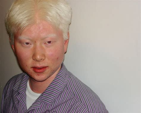 mindsize: albino asian will haunt your nightmares