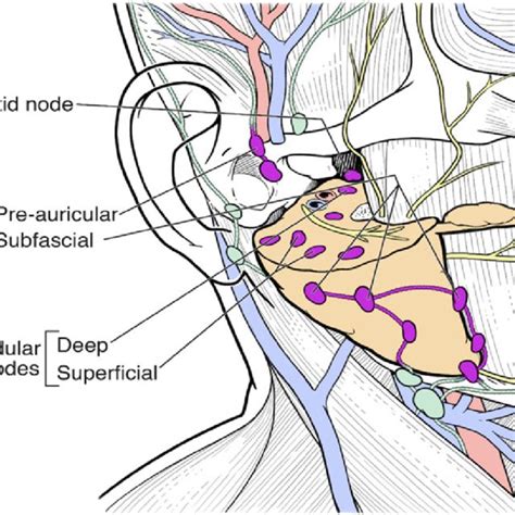 Schematic illustration showing the various subgroups of parotid lymph ...