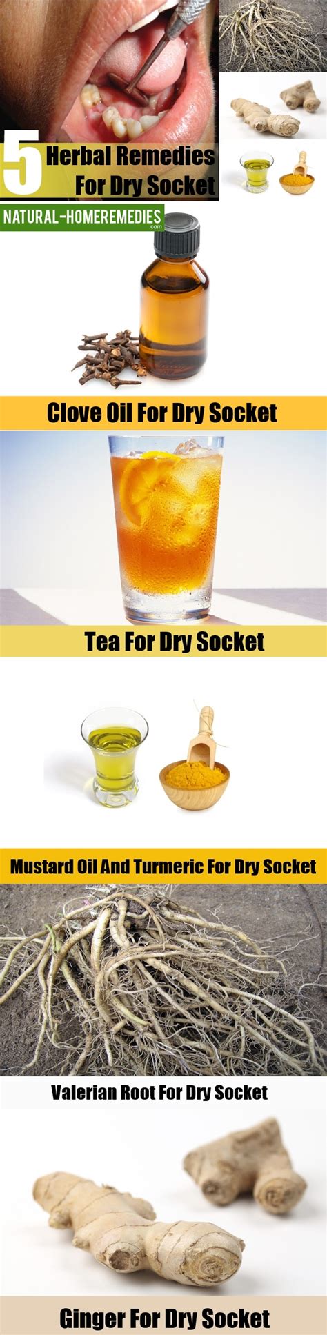 5 Herbal Remedies For Dry Socket – Natural Home Remedies & Supplements