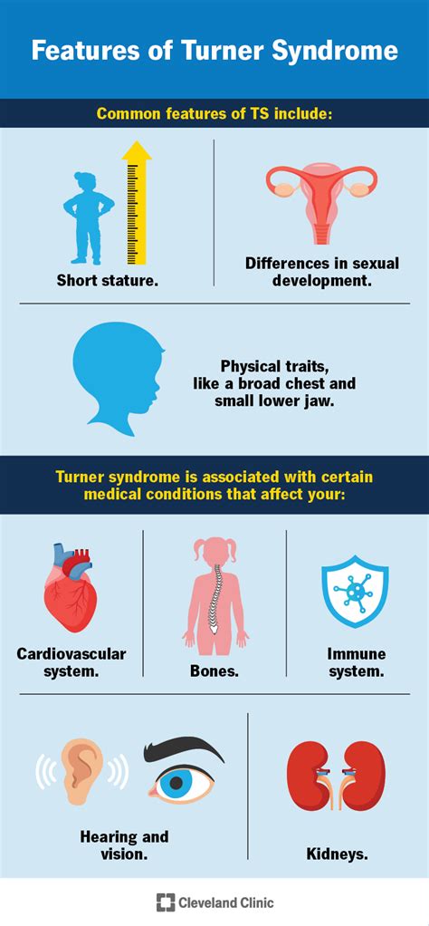 Turner Syndrome: What It Is, Causes, Symptoms Treatment, 54% OFF