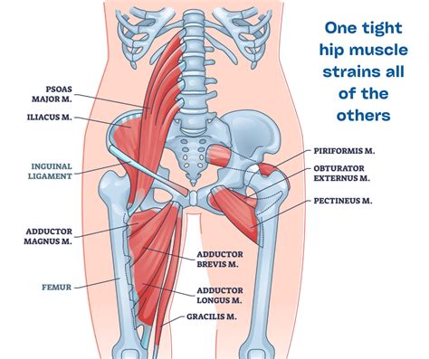 Hip Flexor Pain Causes