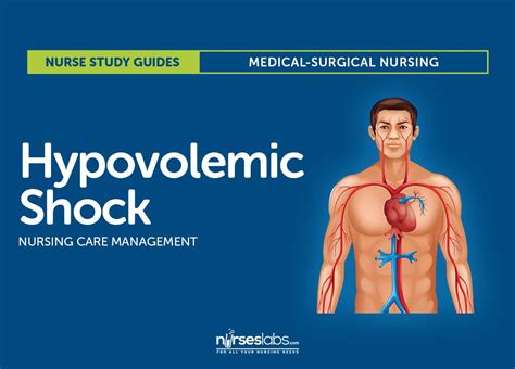 Nursing Case Study Hypovolemic Shock — Related Articles