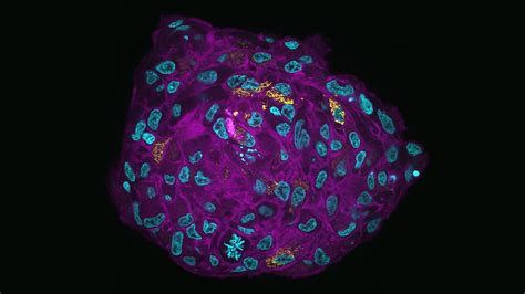 New microscopy technique for effectively studying tumor spheroids - SciLifeLab