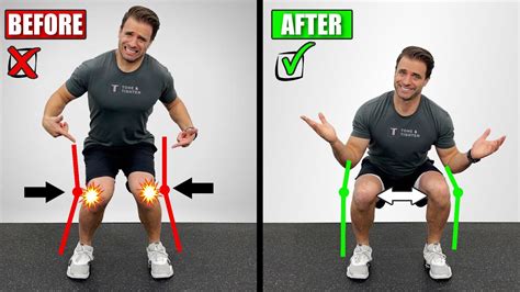 How To Fix Knock Knees (Exercises To Correct Knee Valgus)