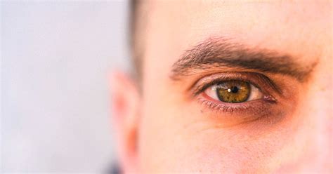 Eye Freckles: Causes, Symptoms, Complications, and Treatments