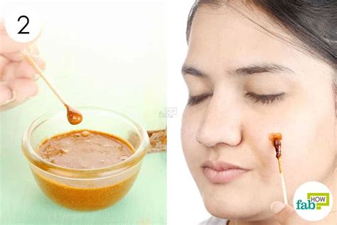 Honey for Acne: Top 10 Remedies and Masks | Fab How