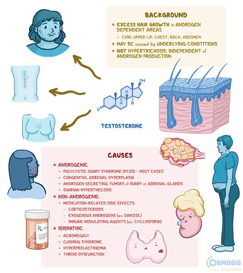 Hirsutism - causes, symptoms, treatment - Healthy Food Near Me