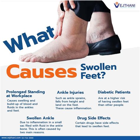 What Causes Swollen Feet?