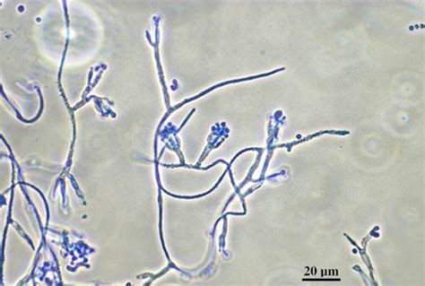 Dimorphic fungi - Life Worldwide