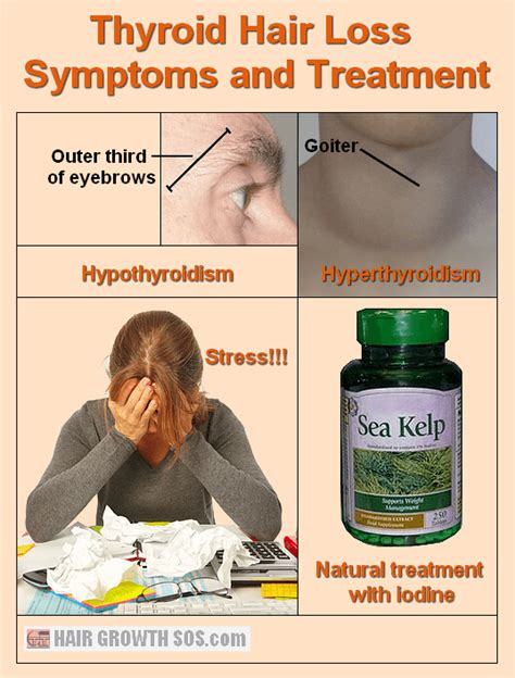 Thyroid Hair Loss Conditions - Symptoms And Treatment Options