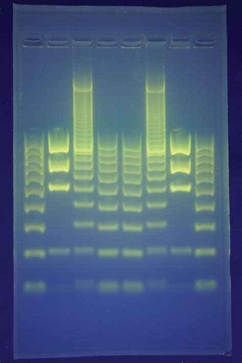 DNA fingerprinting | Definition, Examples, & Facts | Britannica