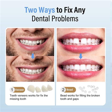 Temporary Tooth Repair Kit, Fake Teeth Replacement for Filling The Missing Broken Tooth and Gap ...