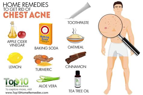 Home Remedies to Get Rid of Chest Acne | Top 10 Home Remedies