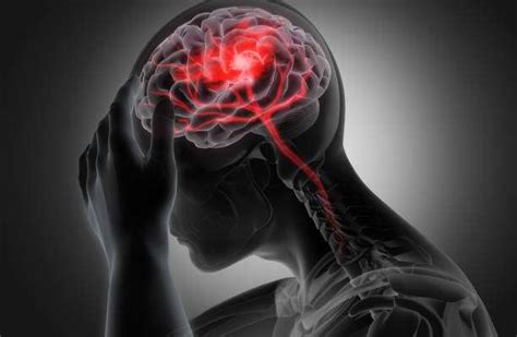 Understanding Neurogenic Shock: Causes To Treatment