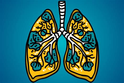 Take A Breath As We Dive Into Lung Cancer - ENCORE Research Group