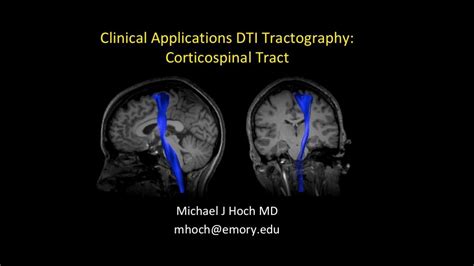 Corticospinal Tract Dti