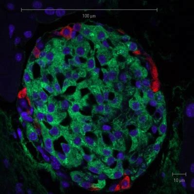 Beta-Cell Function and Failure | IntechOpen