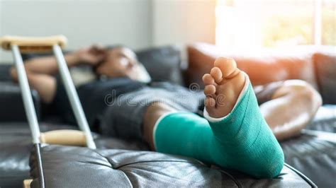 Bone Fracture Foot and Leg on Male Patient with Splint Cast and ...