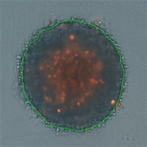 Viability of 3D Tumor Spheroids - Celigo 3D Phenotypical Models