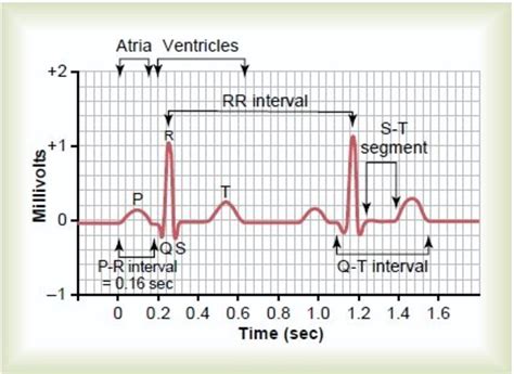 Ekg Interpretation How To Read An Electrocardiogram Ecg | Images and Photos finder