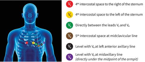 12 Lead Ecg Limb Electrode Placement