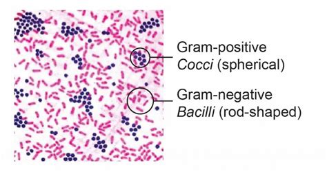 Gram negative bacteria shapes - igoseka