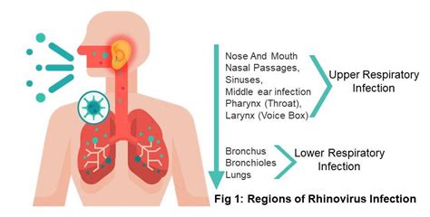 Rhinovirus Infection - Symptoms | Treatment | Prevention