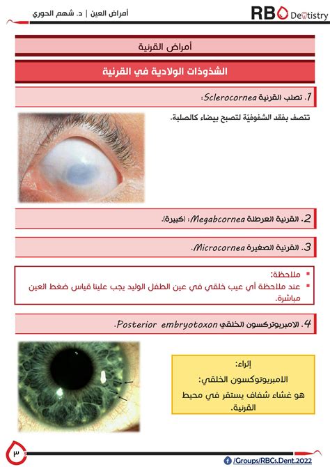 SOLUTION: Corneal and sclera diseases - Studypool