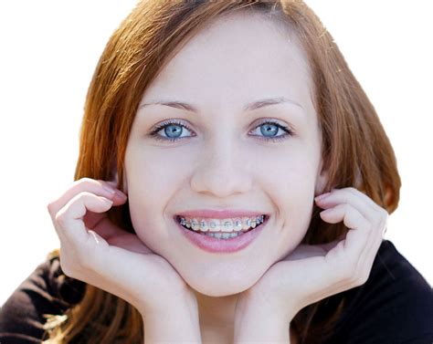 Types of Braces - Kids Dental Online - Plano & Carrollton