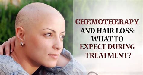 Regrow hair after chemotherapy Lahore Pakistan | Free checkup