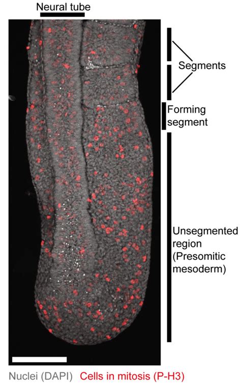 Signalling Dynamics in Tissue Biology – The Sonnen Lab