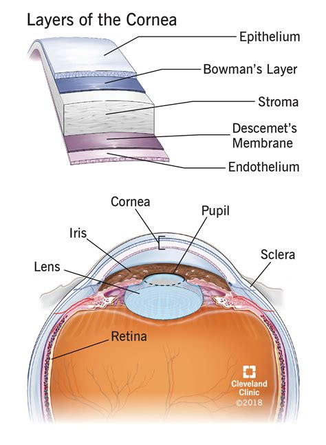 Cornea Transplant Video