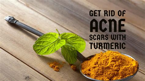 How to Get Rid of Acne Scars using Turmeric