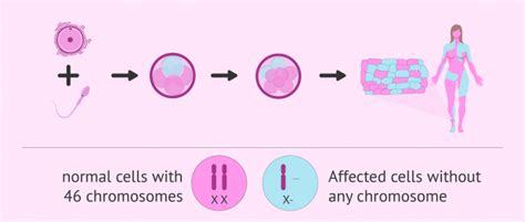 What is Turner syndrome? Its causes, characteristics and pregnancy