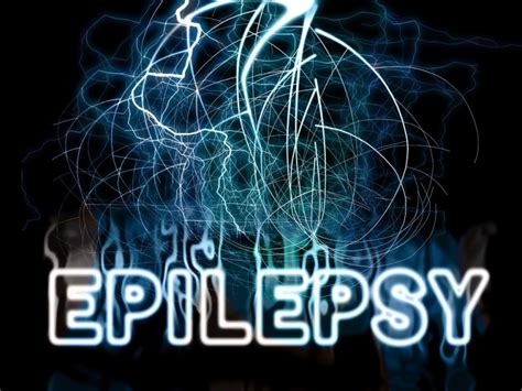 Treat Epilepsy in a Natural Way with These Remedies | Top Natural Remedies