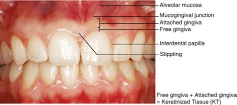 Dental Recession: A Treatable Condition