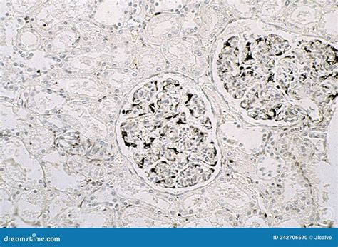 Kidney. Podocytes, Vimentin Stock Illustration - Illustration of technique, identified: 242706590