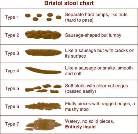 Bristol Stool Chart - The ideal stools are types 3 and 4, especially type 4.