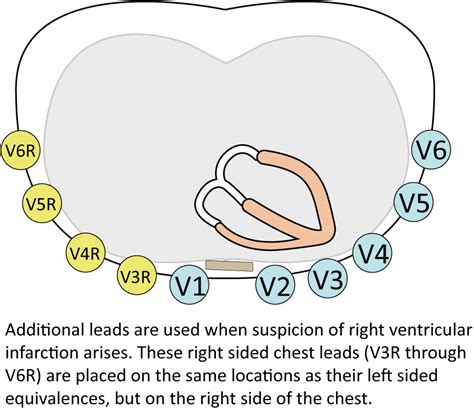 The ECG leads: electrodes, limb leads, chest (precordial) leads, 12 ...