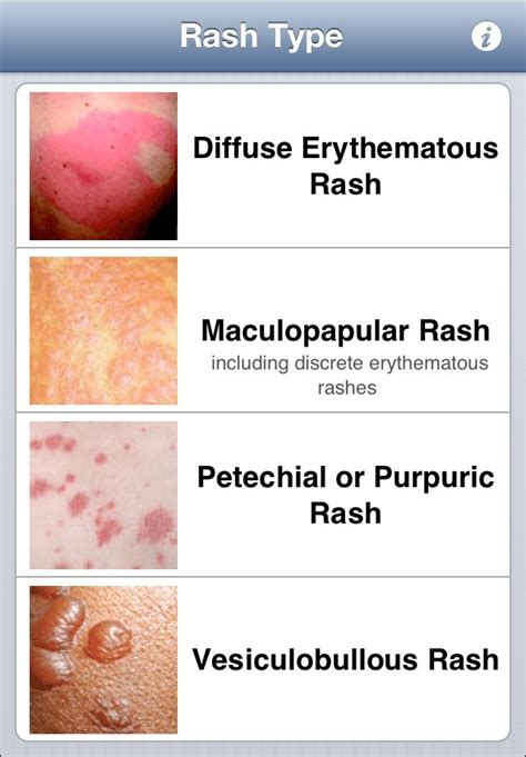 Identifying Skin Lesions