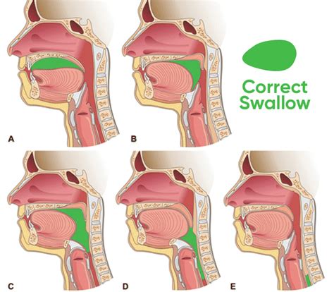 How to Swallow Correctly While Mewing | Mewing.coach