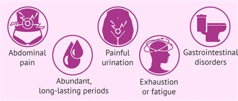 Symptoms of endometriosis