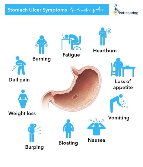 What are the Symptoms of Stomach Ulcer? [Infographic]