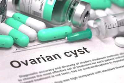 Ovarian Cyst Surgery: What to Expect