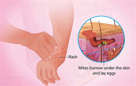 Health Condition : Symptoms, Causes, Treatment and More