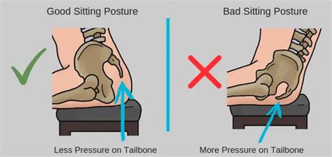 Tailbone Pain (Coccydynia): Causes & Pain Relief& exercise – Qutool® Store